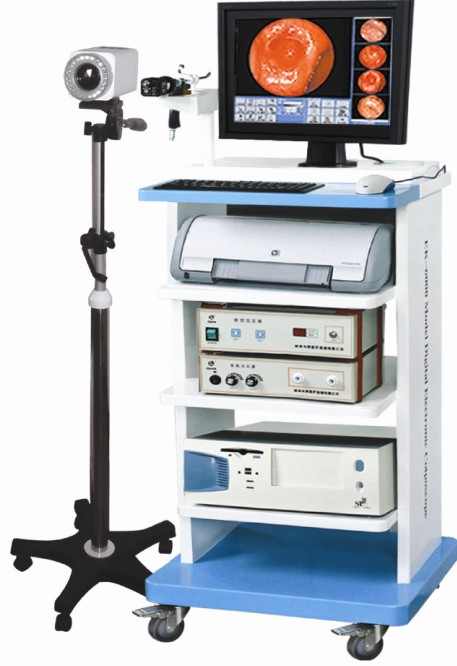 數碼電子陰道鏡